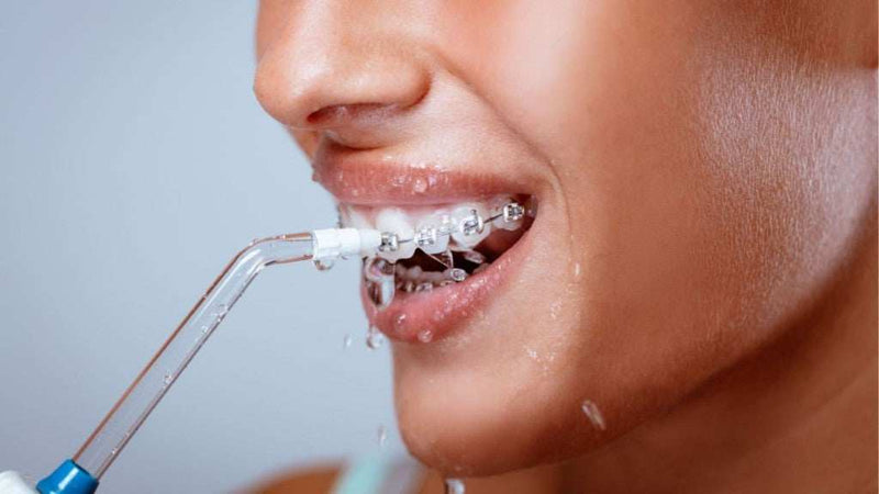 O Que é um Irrigador Dental e Para Que Serve?