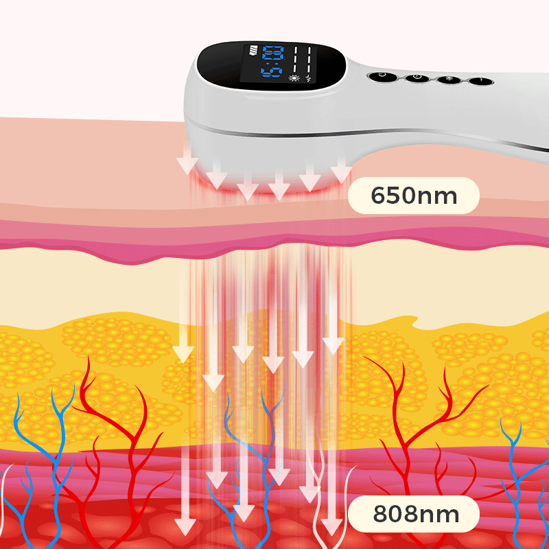 Aparelho De Laserterapia Para Neuropatia