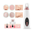 Removedor Elétrico de Cravos e Espinhas A Vácuo Recarregável - Arquitetura da Saúde