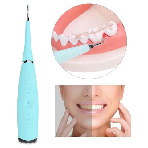 Aparelho de Limpeza Bucal Elétrico para Remover Tártaro e Placas