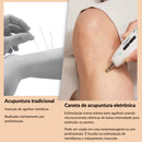 Caneta de Acupuntura