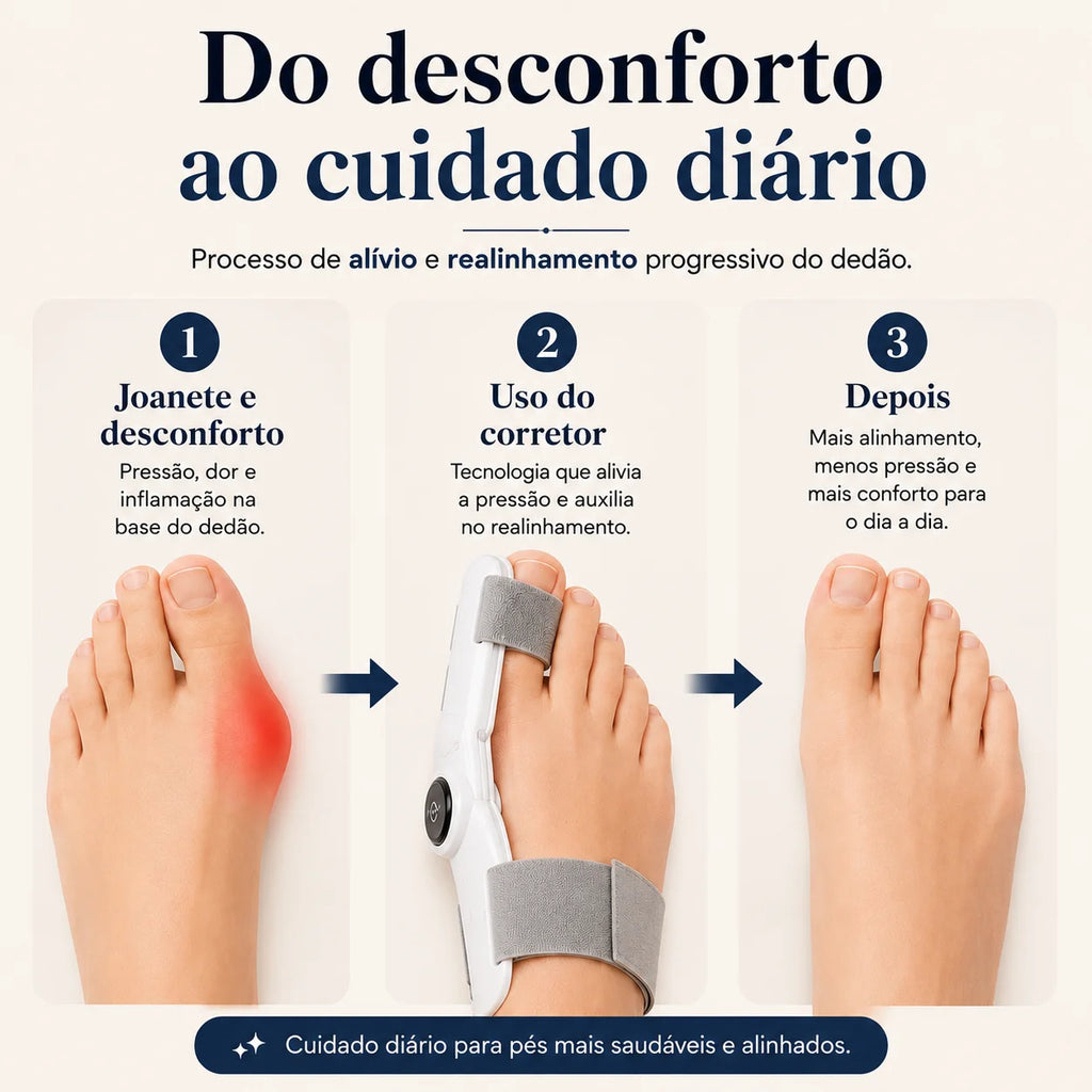 Corretor de Joanete Elétrico Profissional