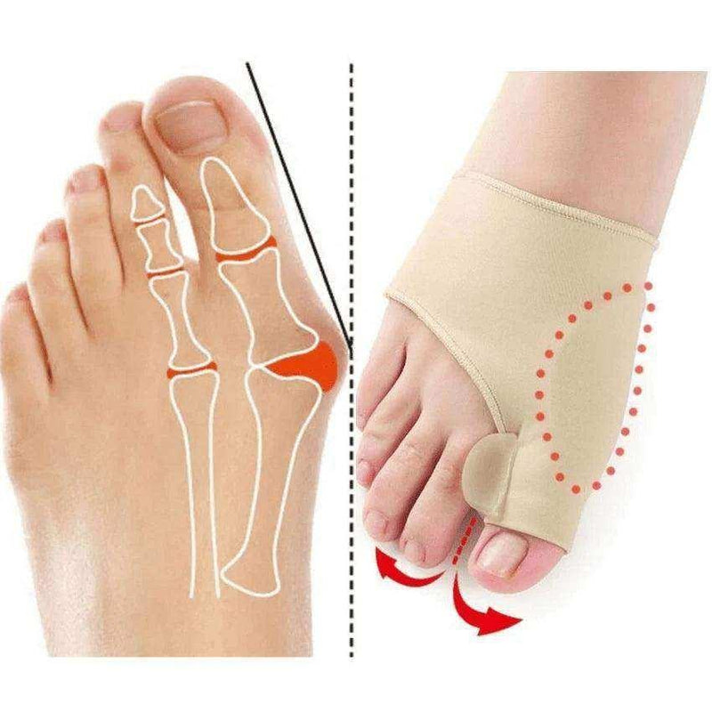 Corretor de Joanete Silicone - Meia Ortopédica - Arquitetura da Saúde