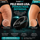 Massageador Para Lipedema e Celulite - Arquitetura da Saúde