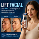 Mini Hifu Ultrassom Portátil Microfocado para o Rosto