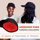 Boné Infravermelho para Tratamento de Calvície Areata